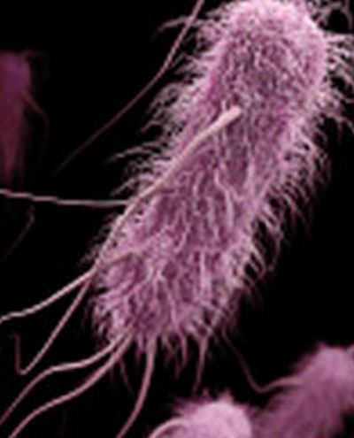 5-MicrobiologySolutionsCard.jpg 5-MicrobiologySolutionsCard.jpg