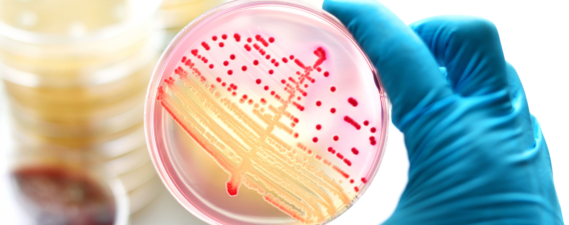 603855044-microbiology-1920x760.jpg 603855044-microbiology-1920x760.jpg