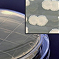 Contact-Plates.jpg Contact-Plates.jpg