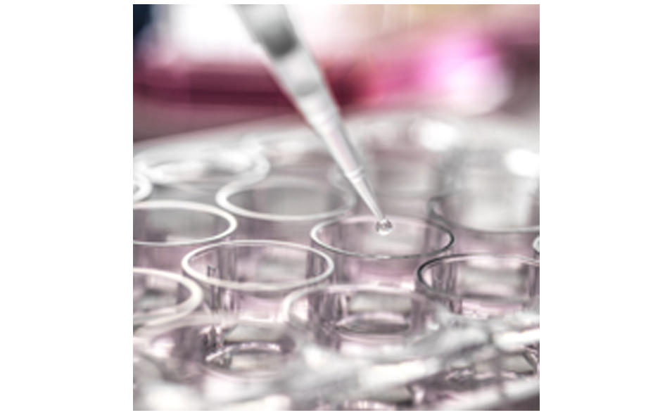 ELISA1.png ELISA1.png