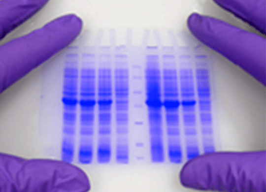 Electrophoresis.png Electrophoresis.png