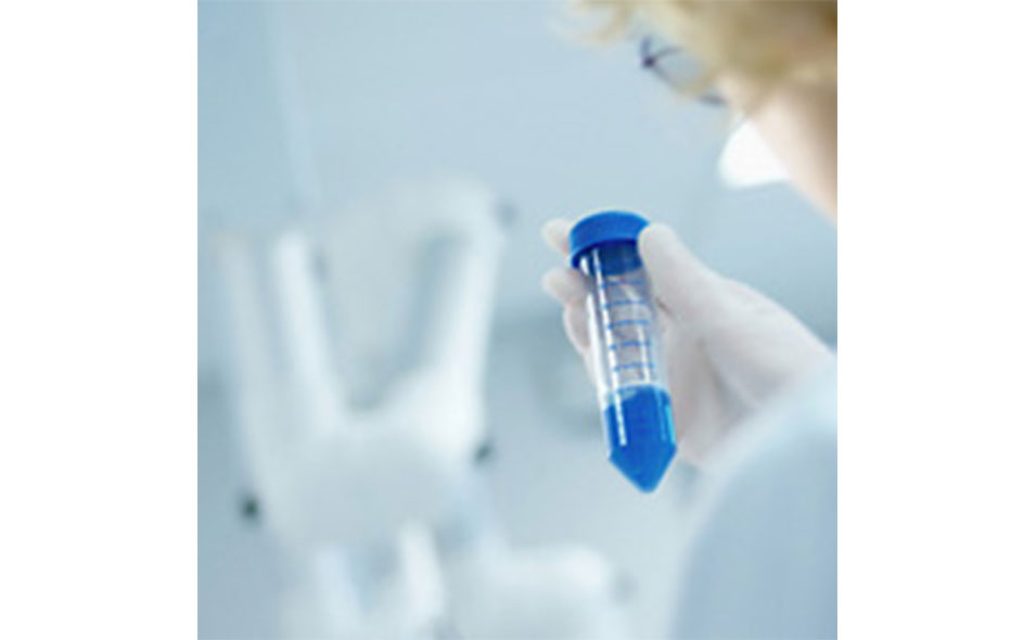 GreinerBioOneSeparation955x590.jpg GreinerBioOneSeparation955x590.jpg