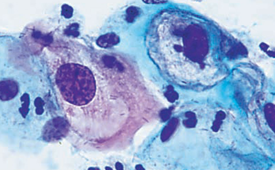 Inverted-Microscopes.jpg Inverted-Microscopes.jpg