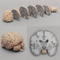 WS_RML_AnatomyPhys_BrainNervSys_200.jpg WS_RML_AnatomyPhys_BrainNervSys_200.jpg