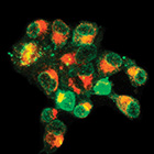 Wards_White_Blood_Cells_140.jpg Wards_White_Blood_Cells_140.jpg