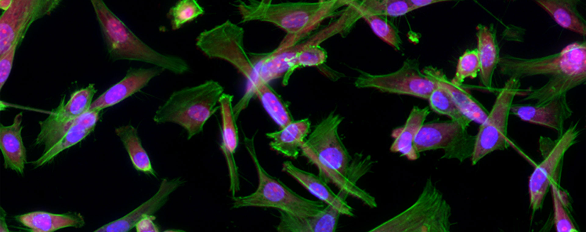 automated-microscopy-774330-1920x760.jpg automated-microscopy-774330-1920x760.jpg