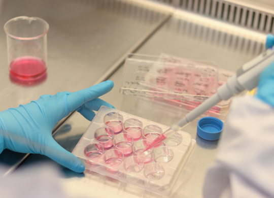 A gloved gene therapy researcher holding a pipette over a plastic container A gloved gene therapy researcher holding a pipette over a plastic container