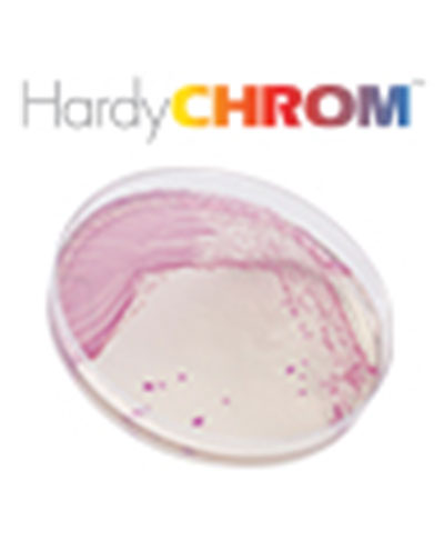 hardy-chrome400x495.jpg