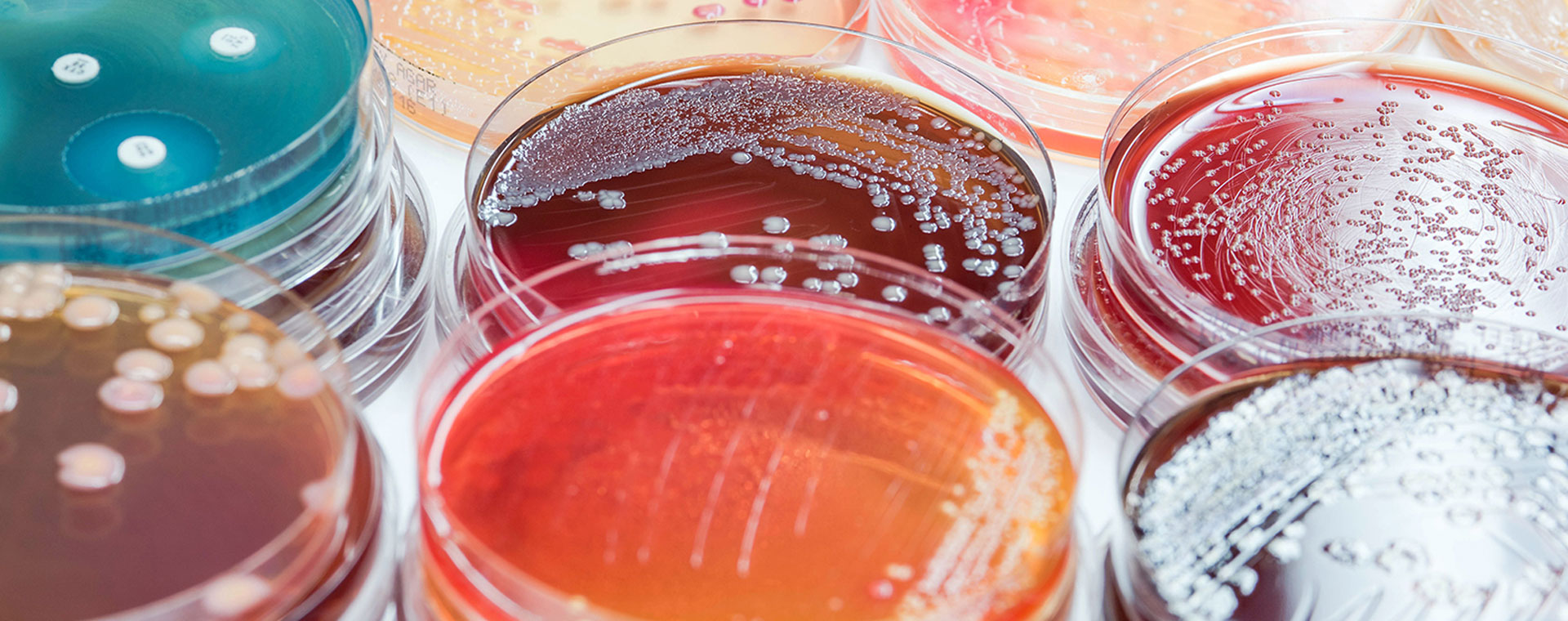 new-food-micro-webinar.jpg new-food-micro-webinar.jpg