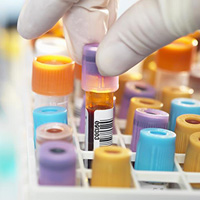 pre-analytics-200x200.jpg pre-analytics-200x200.jpg