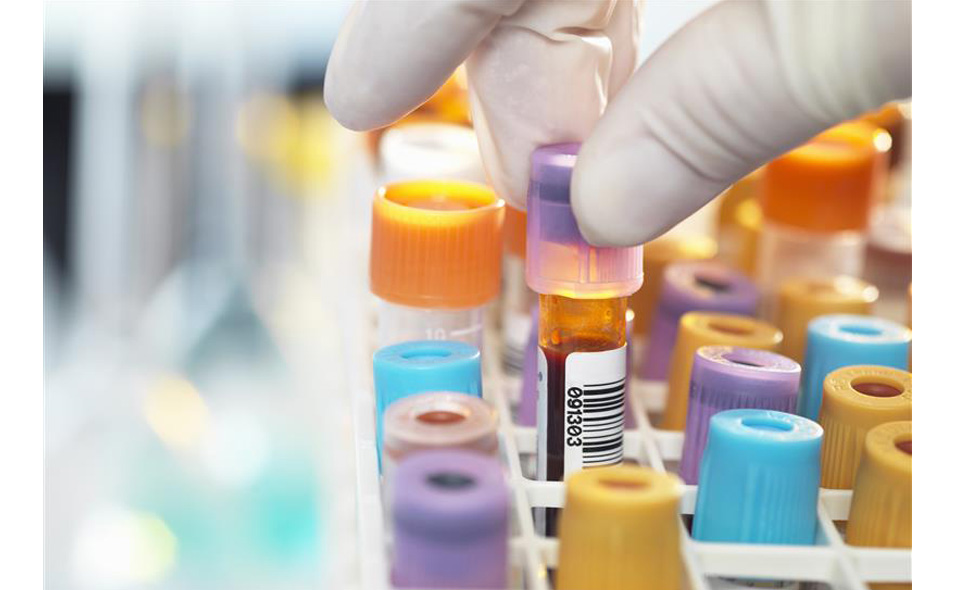 pre-analytics-955x590.jpg pre-analytics-955x590.jpg