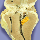 preserved-new-pathology_140x140.jpg preserved-new-pathology_140x140.jpg