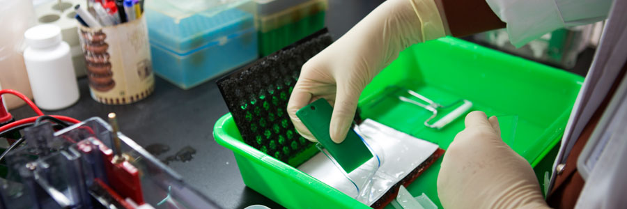 protein-electrophoresis-800x300.jpg protein-electrophoresis-800x300.jpg