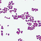 ws_bacteria_microscope_slides_140.jpg ws_bacteria_microscope_slides_140.jpg