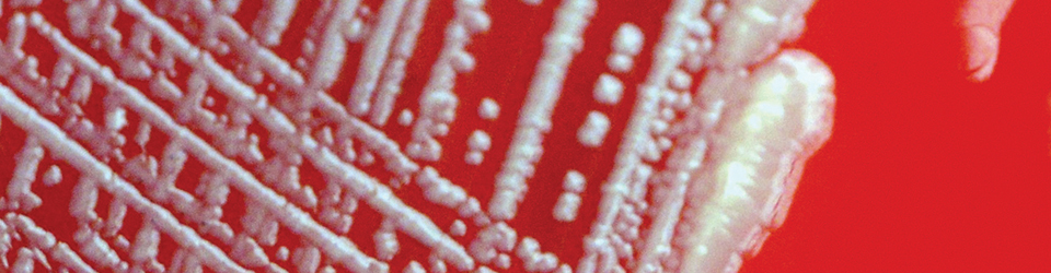 ws_ecoli_960.jpg ws_ecoli_960.jpg