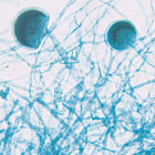 ws_fungi_microscope_slides_140.jpg ws_fungi_microscope_slides_140.jpg